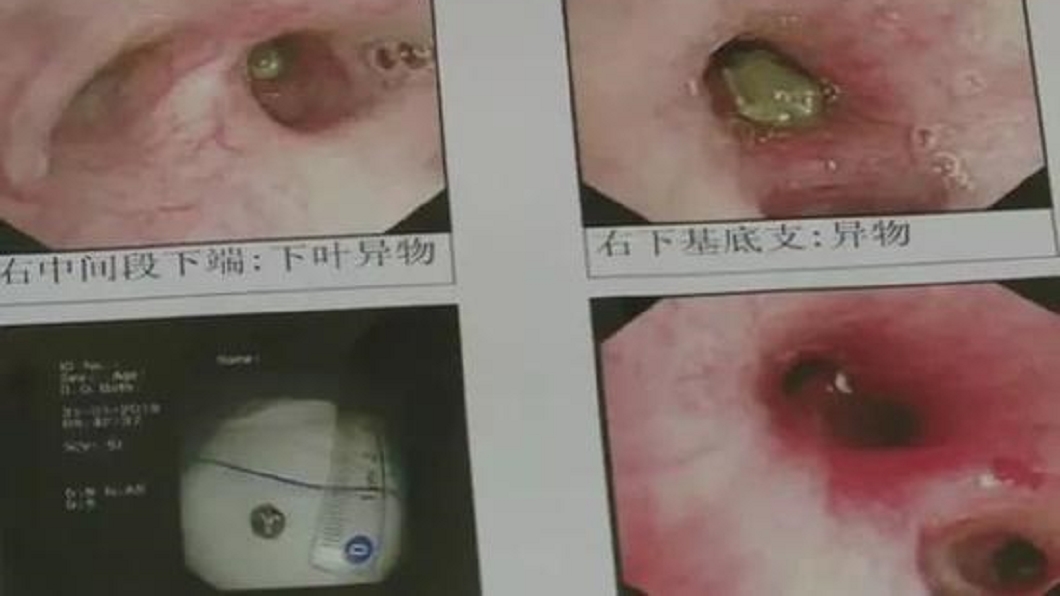 圖／翻攝自《看看新聞》