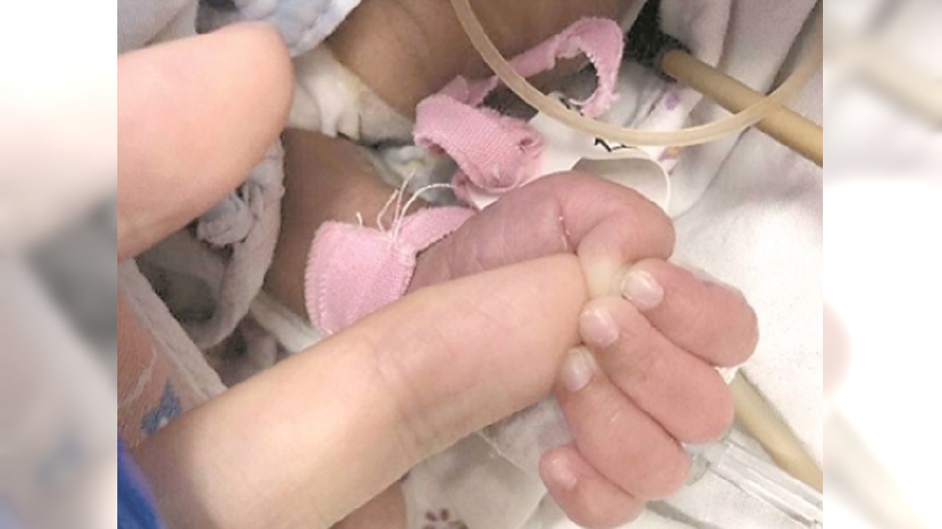 我想活下去!腦積水早產兒 手術前緊握醫手指求生