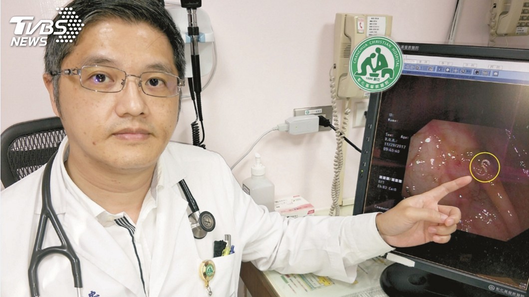 男童農田赤腳玩耍 染鉤蟲引發手腳瘀青