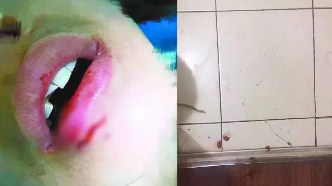 IKEA玻璃杯爆炸斷門牙 陸女求償500萬