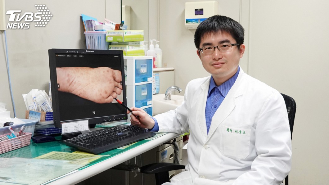 腳底多發性黑斑 要小心與癌症有關
