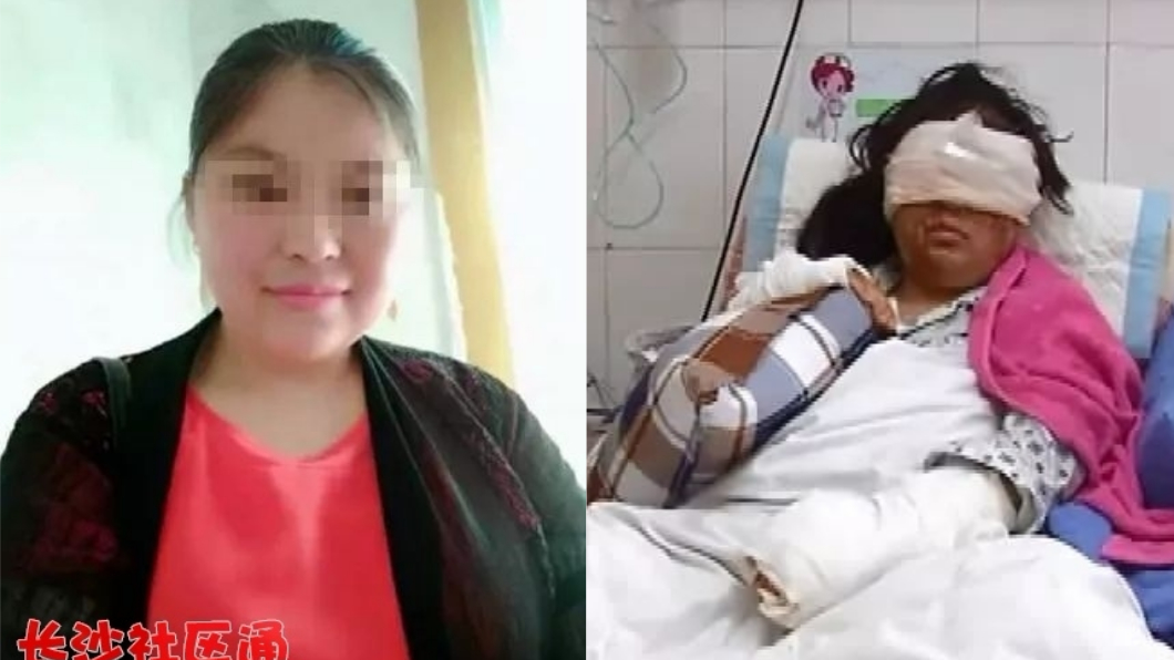 離婚還不到一周!女慘遭前夫水果刀挖眼淋滾水