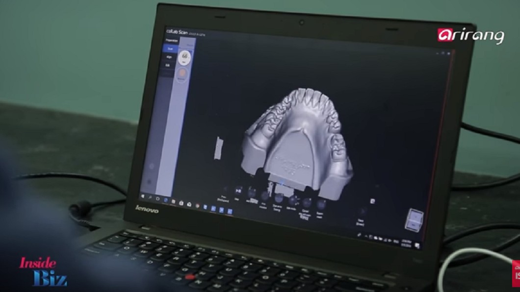 3D掃描器快速顯示 牙科、電玩都適用