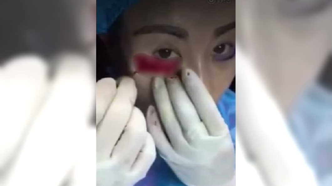 女子直接露出鮮紅的皮下組織。圖/翻攝「重口尸主」微博