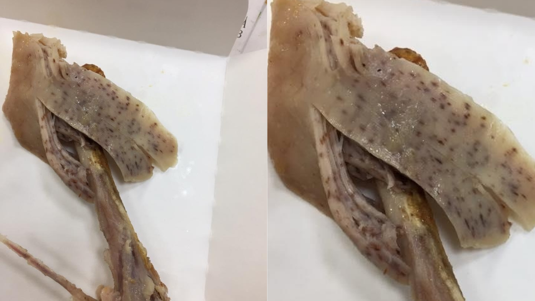 雞腿快啃完才發現…肉上布滿驚悚「暗紅色斑點」