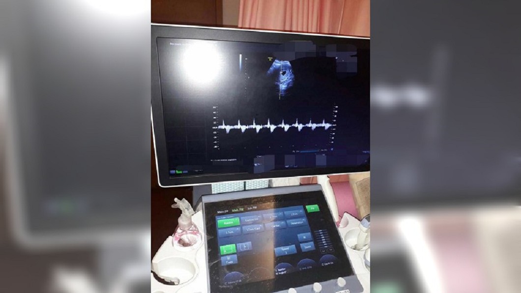 照顧阿公到懷孕? 看護傳「2條線驗孕棒」雇主崩潰