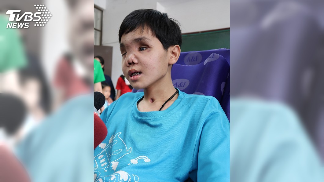 車禍奪走視力腿力　同學陪著跑接力