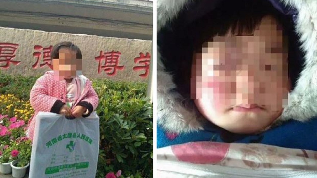 3歲女眼長瘤！爸媽狂募70萬　「收錢蒸發」害她慘死