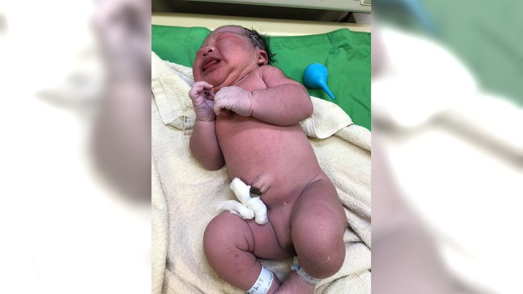 圖/婦產科全方位專家尹長生醫師臉書