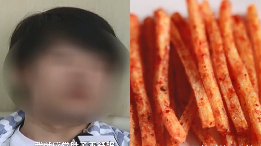 把零食「辣條」當飯吃 24歲男大生腸穿孔險喪命