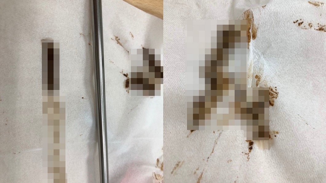 噁！3年沒清「卡管」　環保吸管「拉出一層皮」