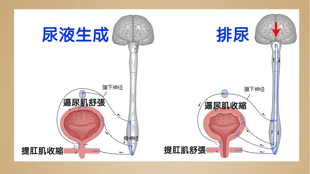 憋尿真要命! 嚴重恐引發敗血症