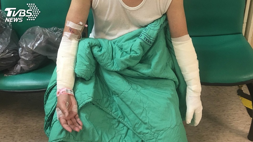 通緝犯揚言自殺鬧事潑鹽酸 3警消灼傷送醫