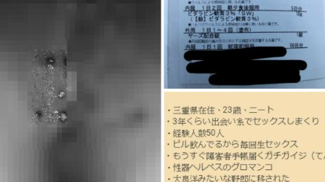 女子得性病,自拍下體照勸世。圖/翻攝自5ch