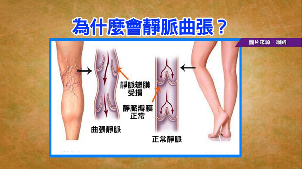 圖/TVBS資料照