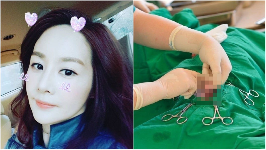 悚!女星開刀一半「麻醉失效」 忍痛噴淚卵巢被亂摘