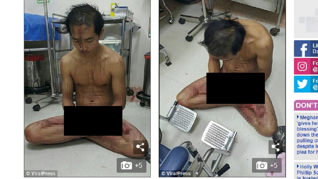 看重鹹色情片太興奮 男割「雞皮」體驗痛感