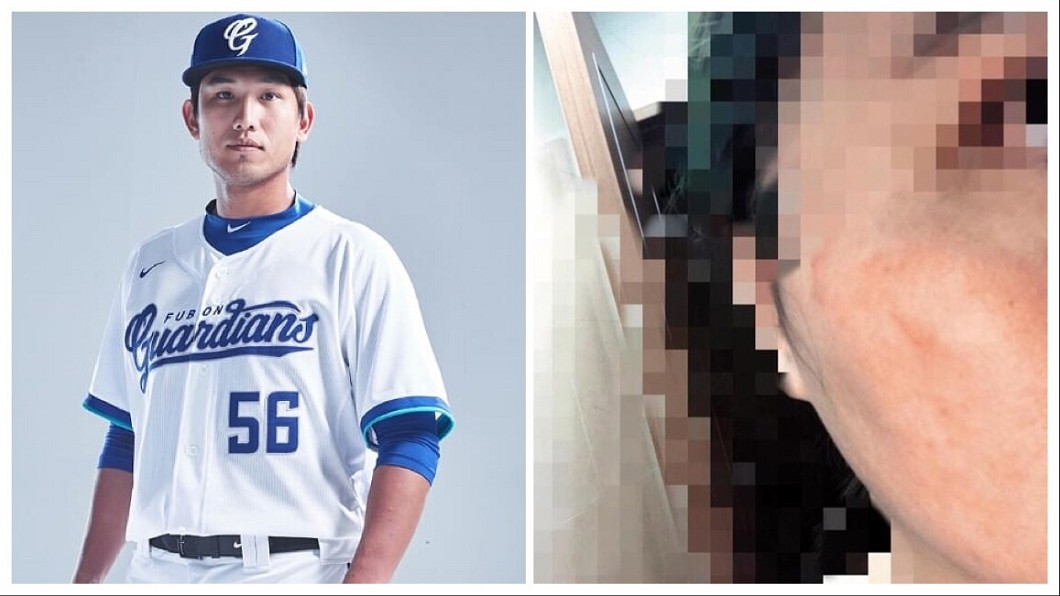 慣性約砲球星驚傳多次家暴 嗆妻:打到妳肯離婚!
