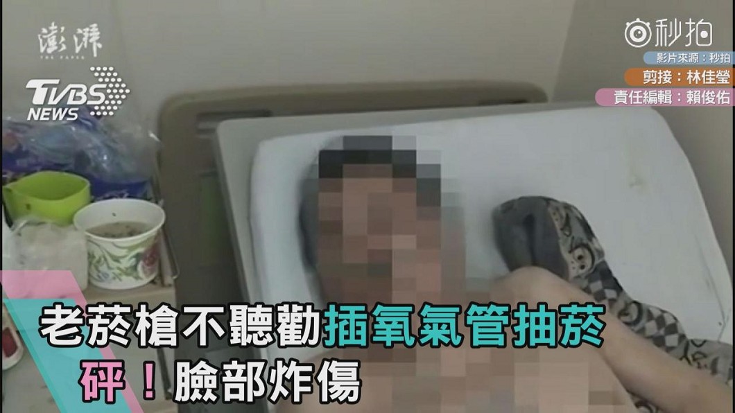 老菸槍不聽勸插氧氣管抽菸 砰!臉部炸傷