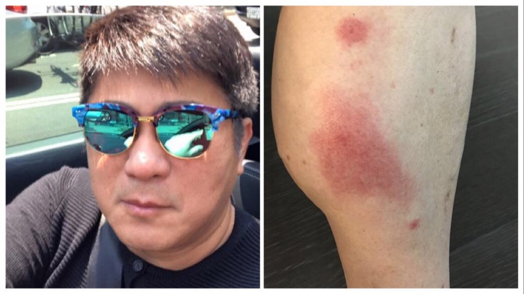 胡瓜被小黑蚊叮差點截肢！腿整隻腫成「戰斧」