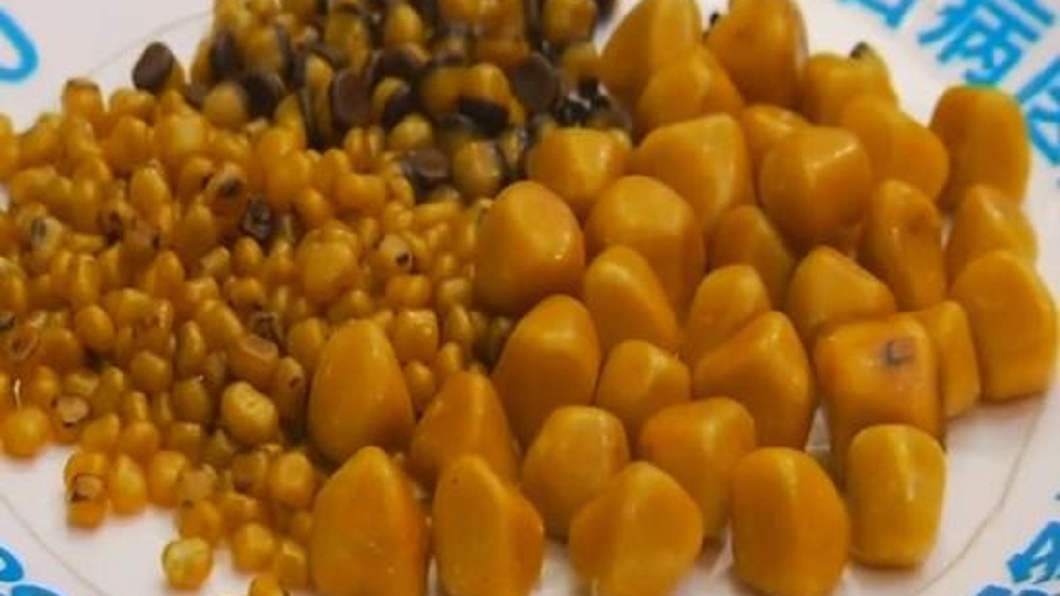 大媽體內取出468顆「琥珀」　全因吃了這一味
