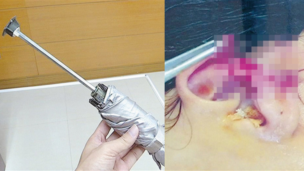 兒把女老師K到腦震盪！父竟回：她靠太近「被打很正常」