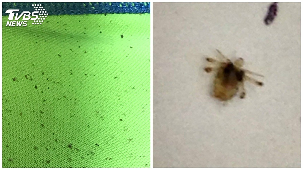 阿伯下體癢陰蝨在爬　尋芳害10小姐中標