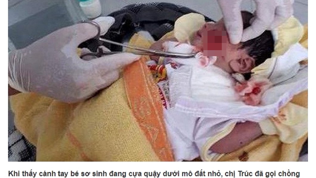 臍帶未剪就被活埋 男嬰手腳伸出地面幸獲救