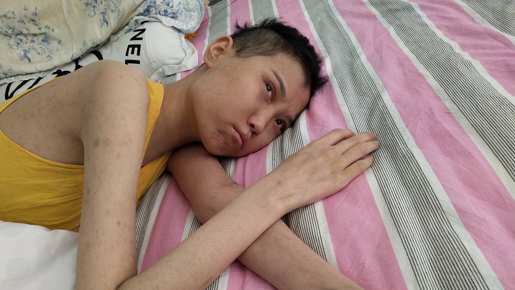女兒罹血癌多次險死求捐骨髓 冷血父:就當我死了吧!