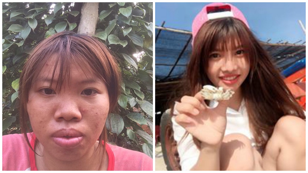 砸42萬整形變正妹 嫁富二代5月被劈腿離婚