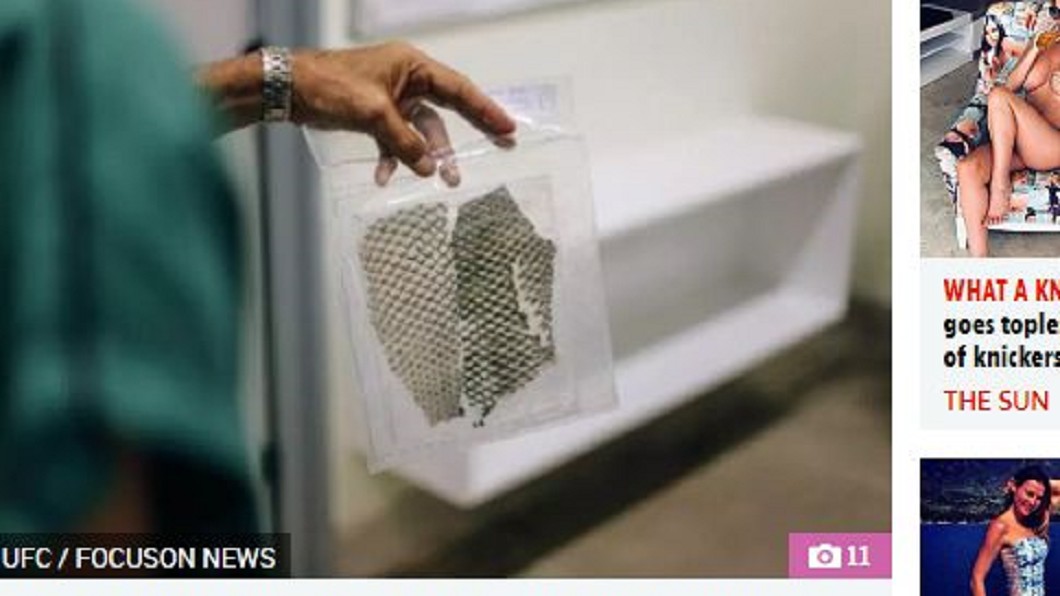 天生無陰道　醫用「魚皮造渠」讓她擁有性生活