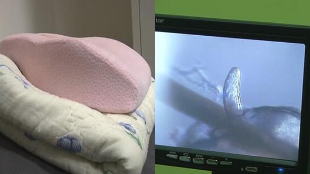 一根睫毛4條蟲!他枕頭套3年沒洗 眼睛長噁心蟎蟲