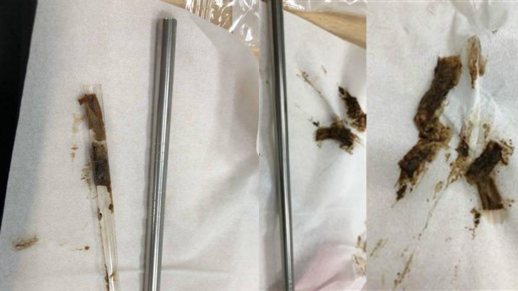 噁!拉出「多條厚黑垢」 他不用鋼鐵吸管3大原因