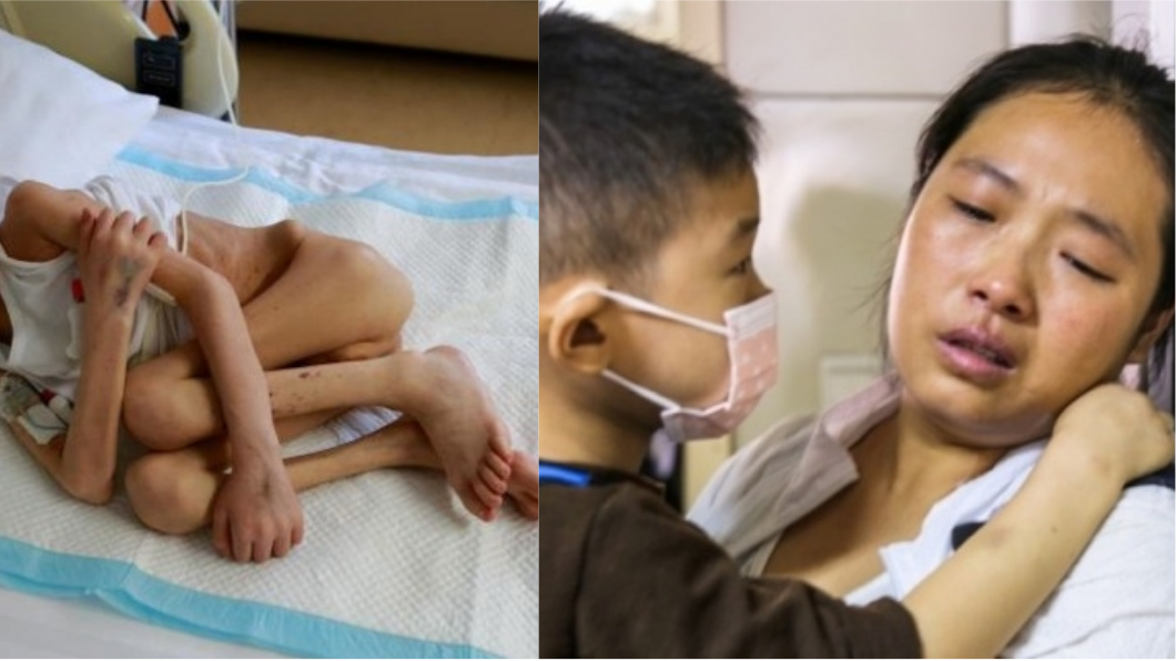 6歲病童心死放棄治療 求母「再生我一次」