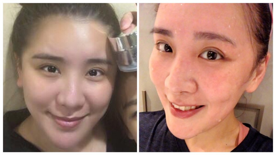 又瘦了!小禎爆汗曬素顏 昔肉包臉→超V型錐子臉