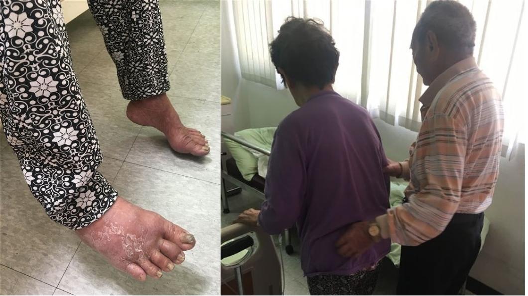少年夫妻老來伴!9旬老翁告白:什麼都不怕,只怕你倒下