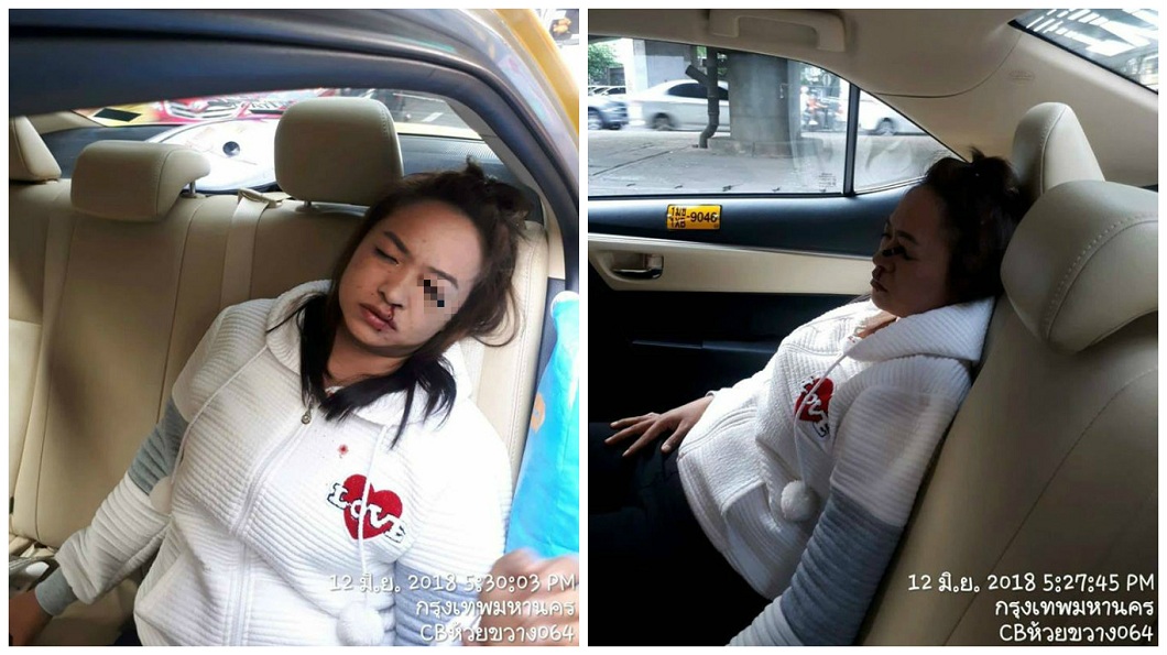 女搭計程車化妝衰遇車禍 眼線筆插進左眼