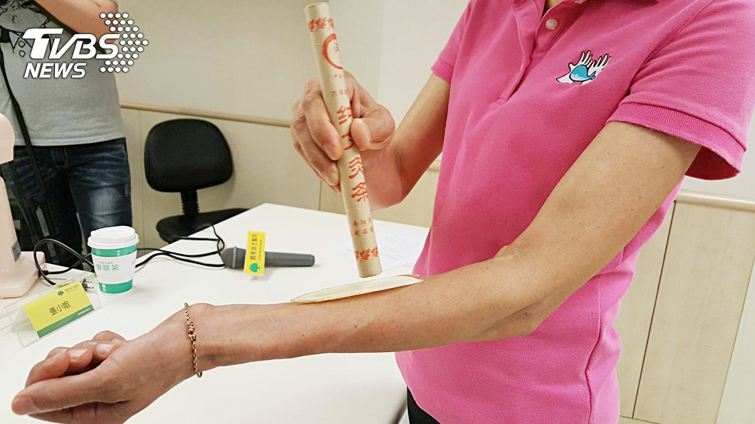 用薑片艾草熱敷解痠痛 婦人小腿嚴重燙傷