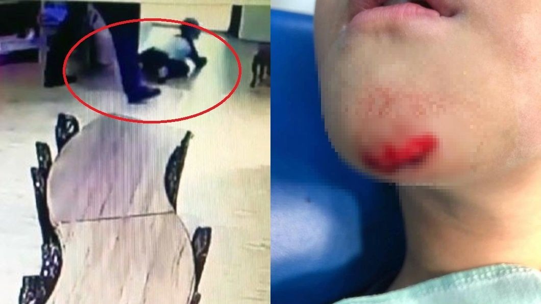 影片曝光！疑遭幼兒園師狠踹　6歲童下巴噴血「縫7針」