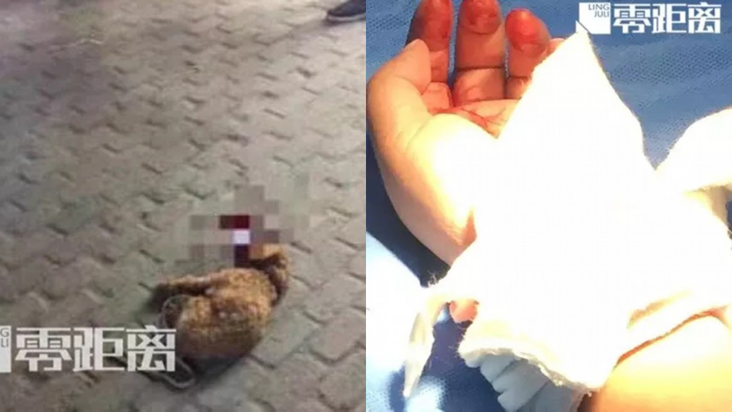 孩被咬！男踩死狗遭網友肉搜　妻割腕「求賠命」