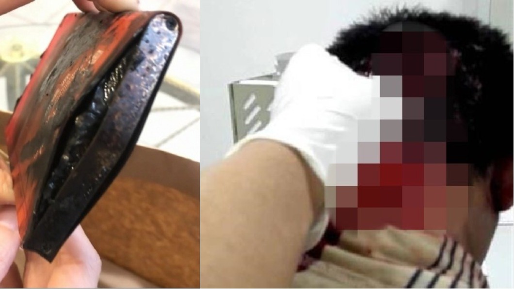 後腦杓冒血!邊看手機邊充電 男睡著被「炸醒」