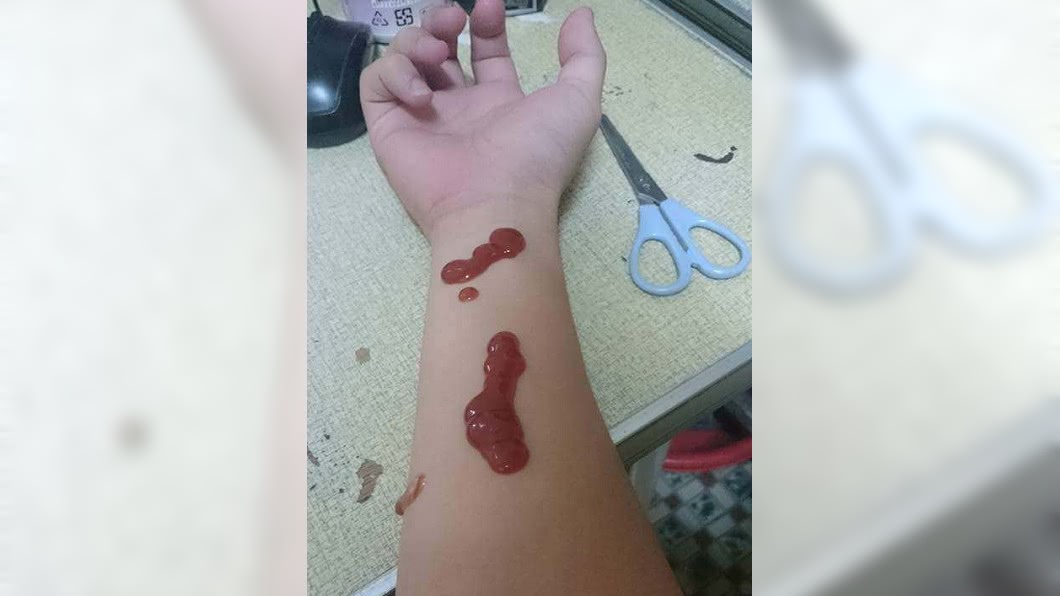 戀愛被阻?國中生「紅醬抹手」割腕 嗆:我會長大