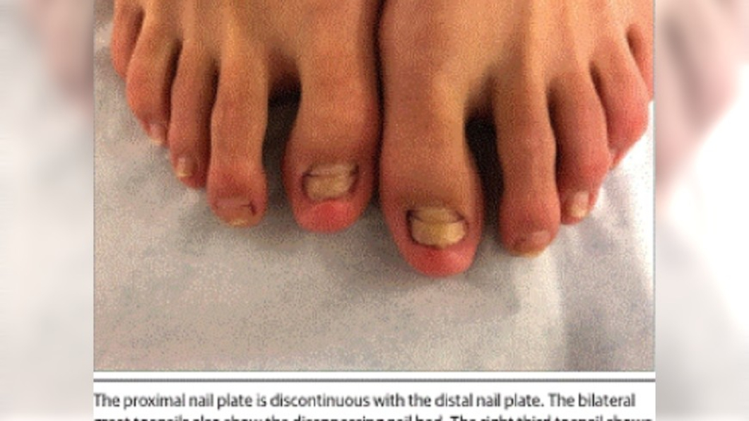 圖/翻攝自JAMA Dermatology