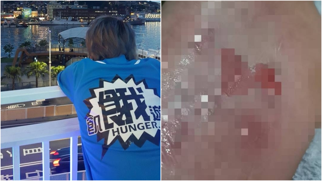 王仁甫錄影受傷! 「腳底破大洞」嚇哭季芹