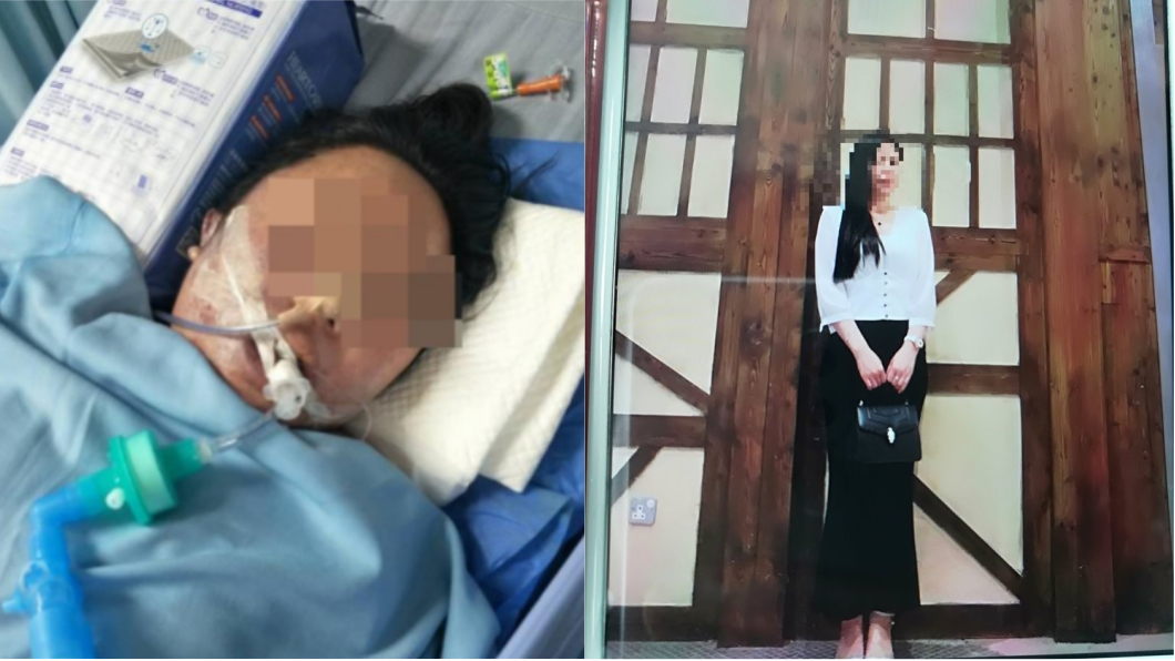 一天做3項整形手術 6天後輕熟女身亡