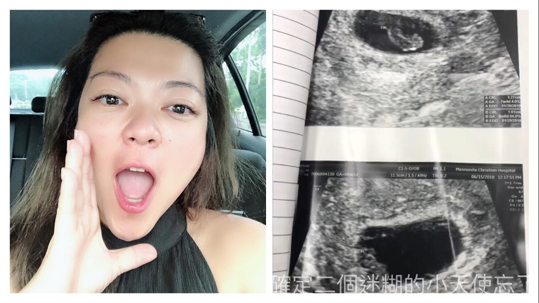 杜詩梅懷雙胞胎嫁花蓮JJ 遺憾婚前小產:天使忘記報到