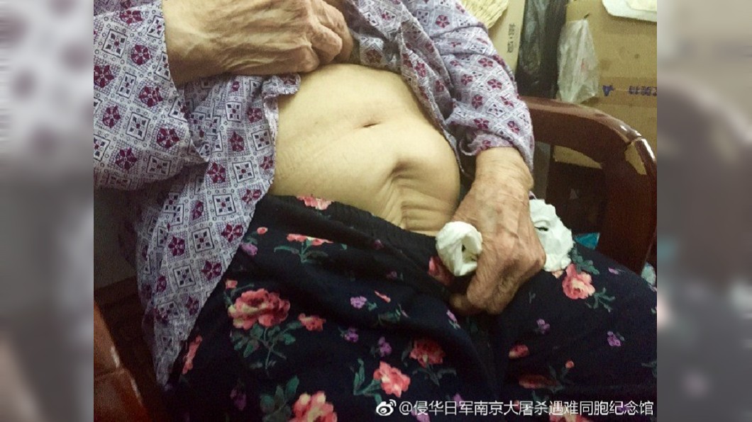 姊妹都淪慰安婦…9旬嬤「肚剖大洞」：永無生育能力