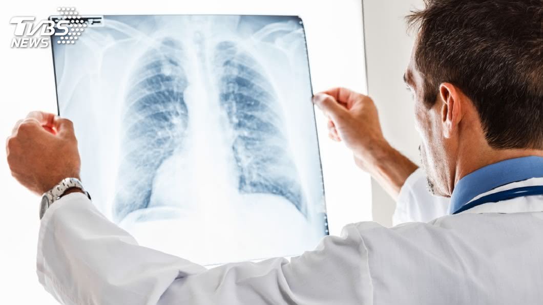 賀一航腸癌三期 醫曝「轉移2器官」:肺像炮彈打過