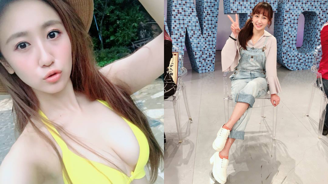 女星上節目頻掛彩 自曝頭部狠撞:像西瓜撞地板