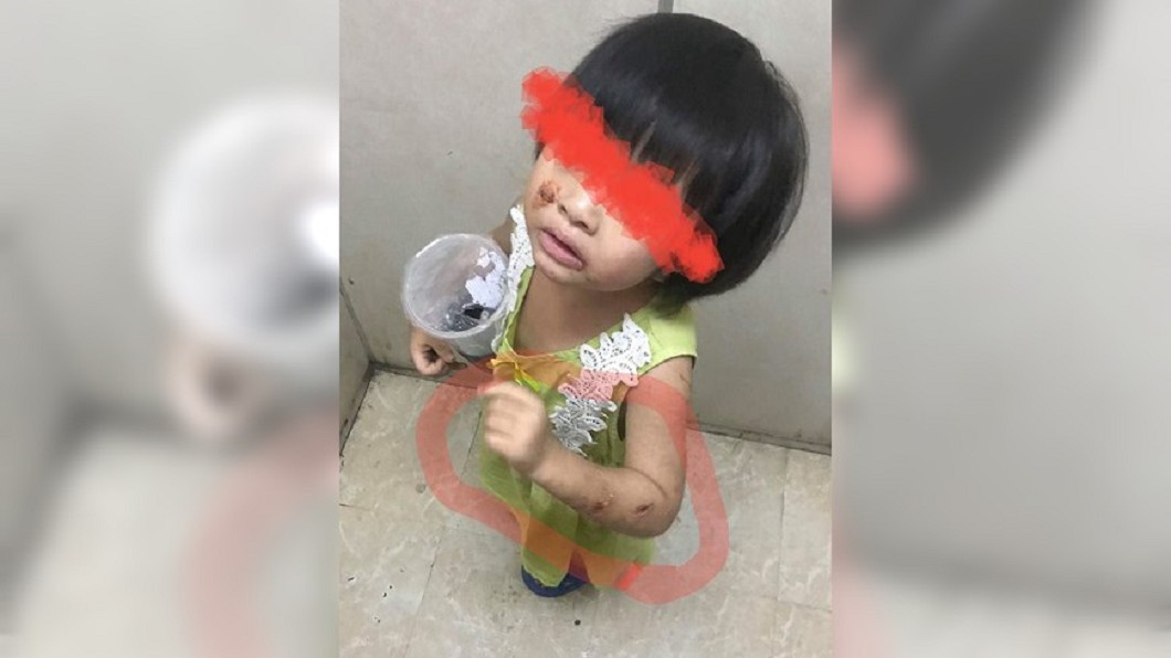 小女童全身傷深夜獨搭電梯　警方還原案件真相